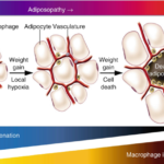 Lipotoxicity and Hidden Metabolic Damage
