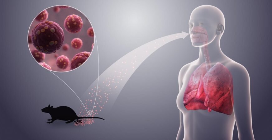 Hantavirus - What It Is and Why It Matters