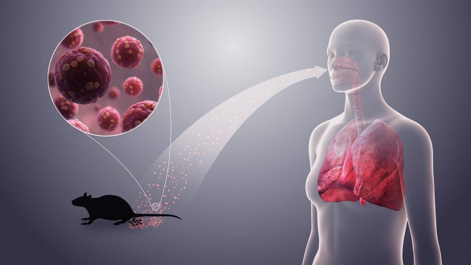 Hantavirus - What It Is and Why It Matters