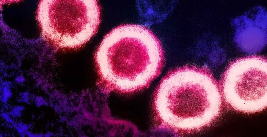 Norway Man ‘Likely Cured’ of HIV After Stem Cell Transplant From Brother