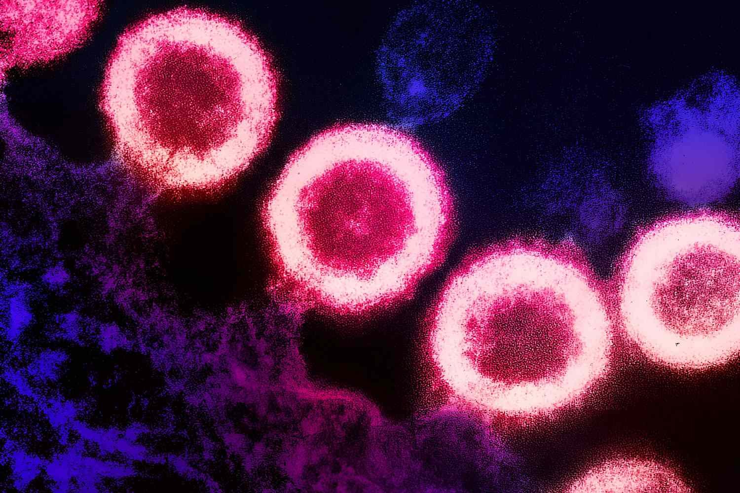 Norway Man ‘Likely Cured’ of HIV After Stem Cell Transplant From Brother