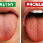 Dry Mouth: Why Does It Happen, and Which Treatments Actually Help?